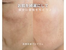 サラモ(Sa La Mo)/なりたい肌を目指そう