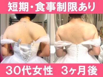 ユリシード 大阪分院(Ulyseeed)/ウェディングには当院の技術で