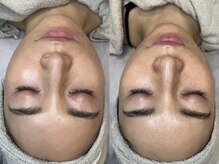 ムゥ(Mwoo)/ララピール/ララピール西宮