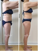 バニスティ 鶴岡店/ヒップラインとあしライン綺麗に