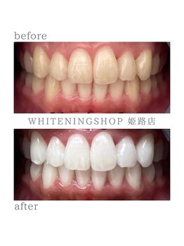 ホワイトニングショップ 姫路店/ホワイトニング