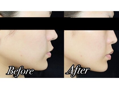 アッヴェリーレ(A'bbellire)の写真