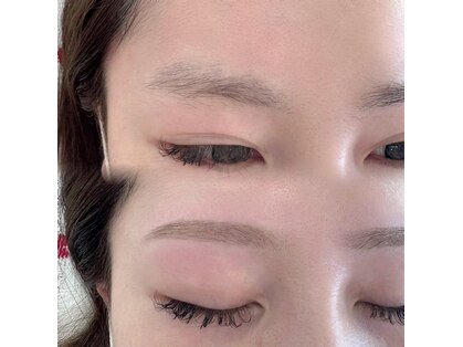 シュナ(SCHNA)の写真