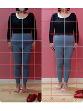 骨盤ダイエット専門サロン【骨盤ちゃん】ガーデン前橋店/Before/After/姿勢改善