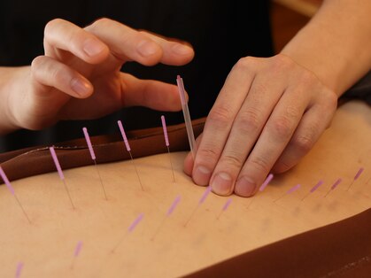 なんくる鍼灸治療院の写真