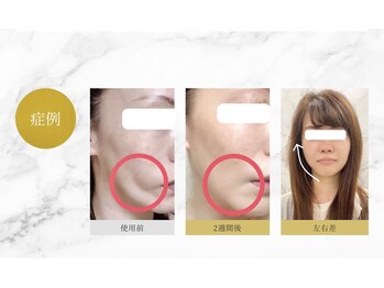 ティアモ(Ti Amo)/今よりもお顔が小さくかわいく♪