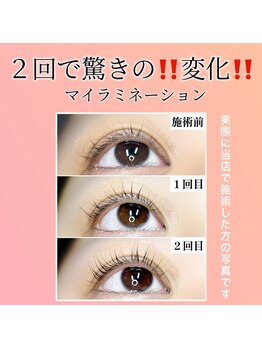 ピュールホワイト(Pur white)/まつ毛が驚きの変化！！