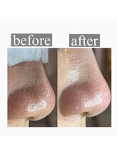 ライカブルー(RaicA BluE)/施術写真　before-after