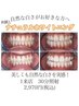 【初回限定】黄ばみが気になる方に◎セルフホワイトニング30分体験