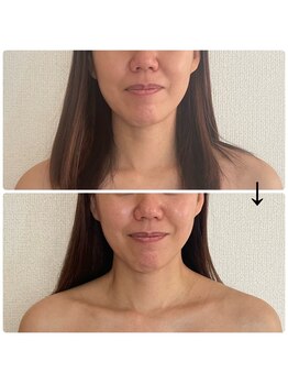 サロン スピカ/結果重視のフェイシャルエステ1