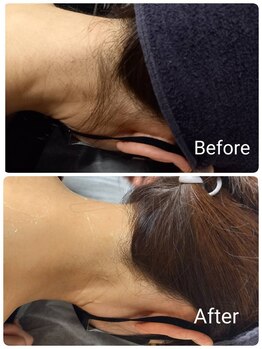 スマイルボディ つぼの森 伊集院店(Smile body)/☆ レディース/うなじWAX+光☆