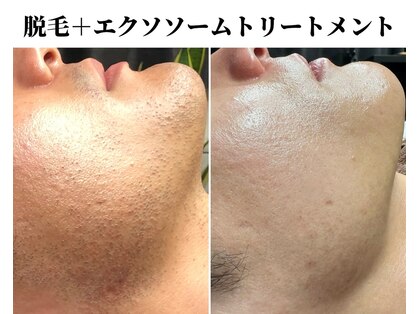 キムラケ(KIMURAKE)の写真