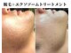 キムラケ(KIMURAKE)の写真