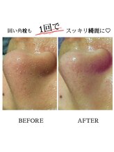 フルーヴ ルフレ(Fleuve Reflet)/冬でも脂っぽいテカってる方に！