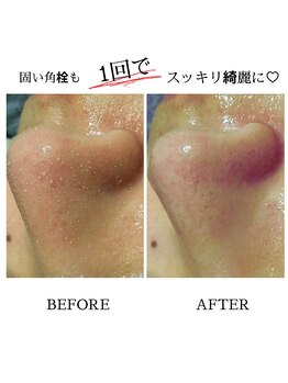 フルーヴ ルフレ(Fleuve Reflet)/冬でも脂っぽいテカってる方に！