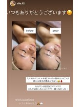 小顔 ツヤ肌/お客様の声