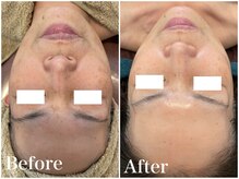 サロンドフェイス(Salon de Faith)/ハーブ3回目の変化♪