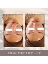 ルーク(Luke)/ビフォーアフター