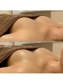 プリマベラ 大阪梅田(primabella)/一回で驚きのハリ弾力！