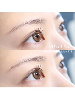 ウィラレア(UILALEA)/L3リフト