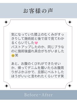 カルム(Calme)/腸もみがバストアップには必要