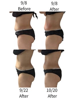 ララナ バイ カノア(LALANA by kanoa)/