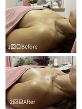 チュラ 大宮店(Chura)/【40代】バストアップ2回目@大宮