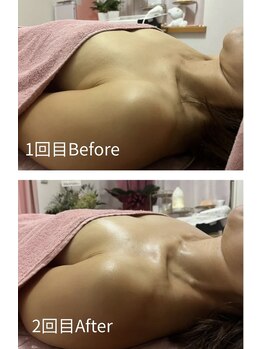 チュラ 大宮店(Chura)/【40代】バストアップ2回目@大宮