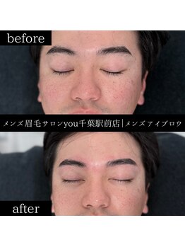 ユー 千葉駅前店(you)/ビフォ－アフター写真