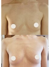 プレジール/バストボリュームアップ