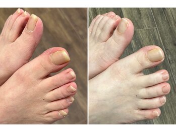 足の爪切り¥3500