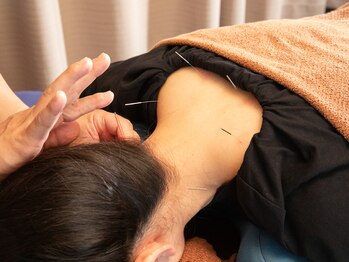 歩鍼灸院整骨院