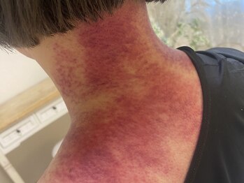 コル コルエ(koru korue)/生理系の不具合は大体血の巡り