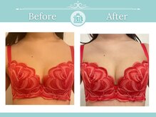 美人バスト 吉祥寺店/バストアップ　★☆症例写真☆★