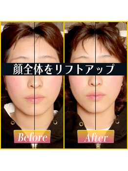 てんてんてんまてん/小顔矯正/骨盤矯正/整体/肩こり