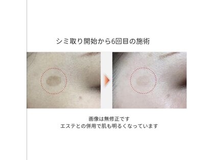 じゅえるの写真