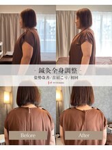 ヒノト(Hinoto)/姿勢改善/巻き肩/首肩こり