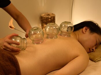 錦の写真/【冷え改善・血行促進に☆】吸い玉(カッピング)+整体 60分 ¥6000 血行を促進し全身ポカポカ♪