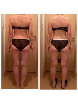 サロン ド マーシャ(salon de Marsha)/肩こり、背中の張りにも！