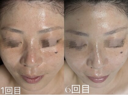 ウィハナ(wehana)の写真