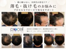 シャラ(shara)の雰囲気（【プロセルセラピーズ】ダウンタイムなしの育毛促進◎）