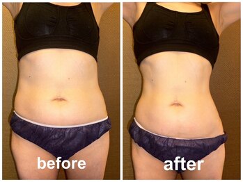 ヴィヴィット 胡町店(Vivid)/5ヶ月間！ー14.5cm