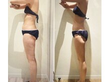 アユアランリンク 札幌店/30代前半/約2ヵ月半/-3.7kg/側面