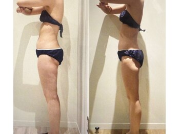 アユアランリンク 札幌店/30代前半/約2ヵ月半/-3.7kg/側面