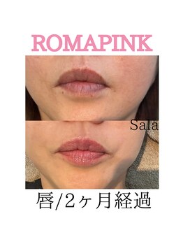 サラ/ローマピンク