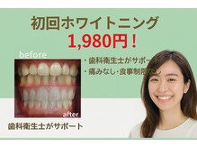 ココホワイトニング(coco whitening)