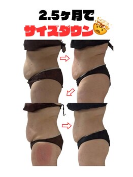 ララナ バイ カノア(LALANA by kanoa)/