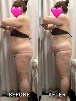 ベルミーランド MEGAドン・キホーテ草加/痩身Before→After