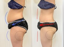 ステイゴールド美容整体院(STAY GOLD)/ポッコリお腹諦めないで！！