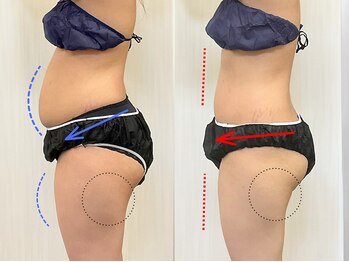 ステイゴールド美容整体院(STAY GOLD)/ポッコリお腹諦めないで！！